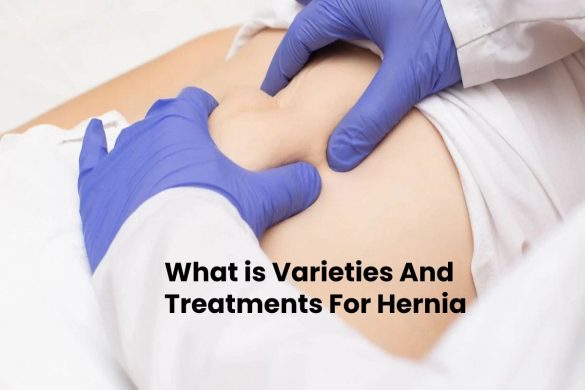 What is Varieties And Treatments For Hernia - 2022